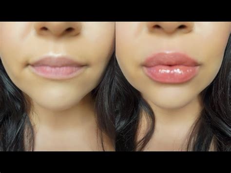 lip plumpers without injections.